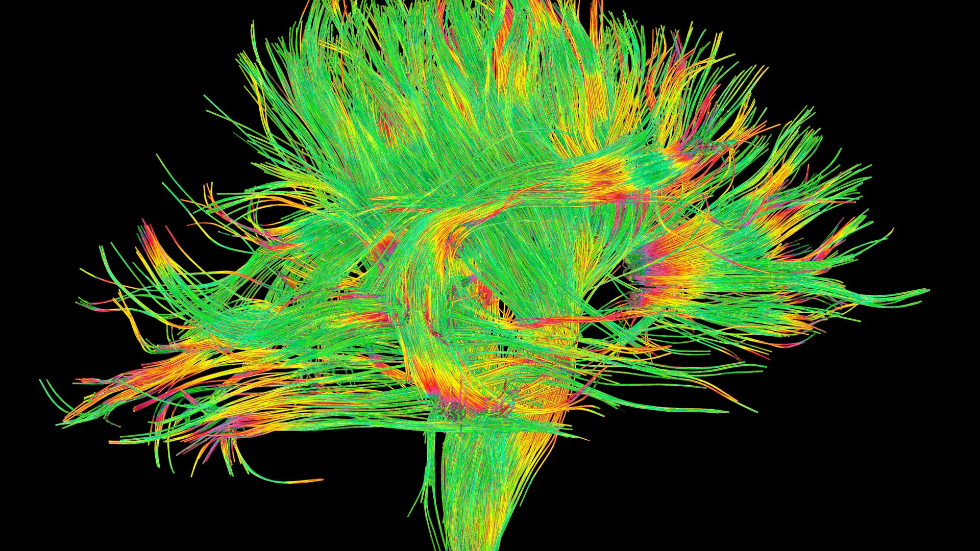 Abstraktes Kunstwerk, das aus vielen neonfarbenen (vor allem grünen) Linien eine Art Baum darstellt.